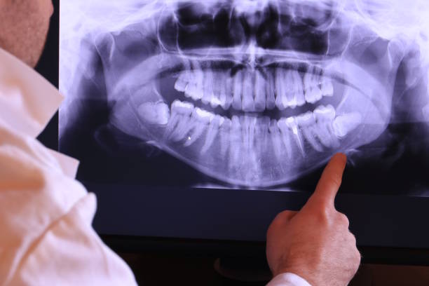 Best Emergency Broken Tooth Repair in West Mayfield, PA